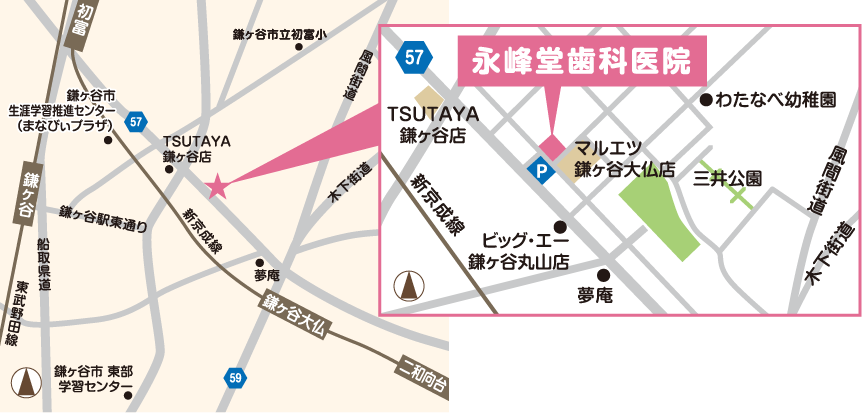 狭域マップ